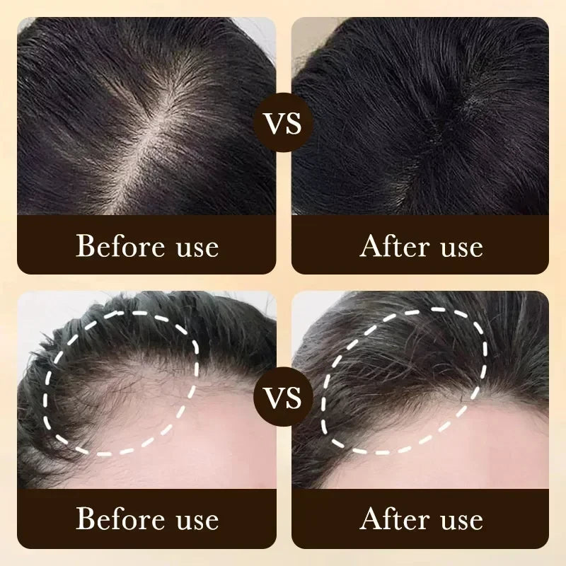 Biotin Hair Growth Oil