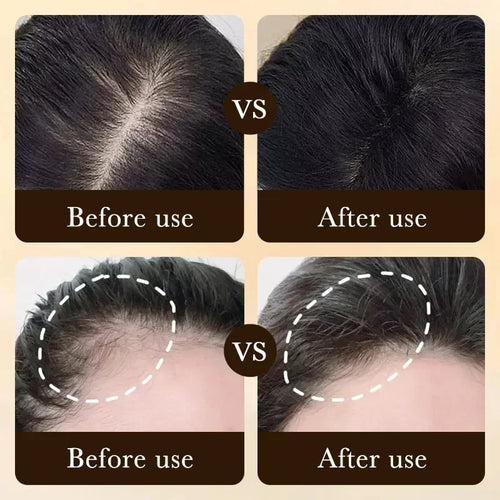 Biotin Hair Growth Oil